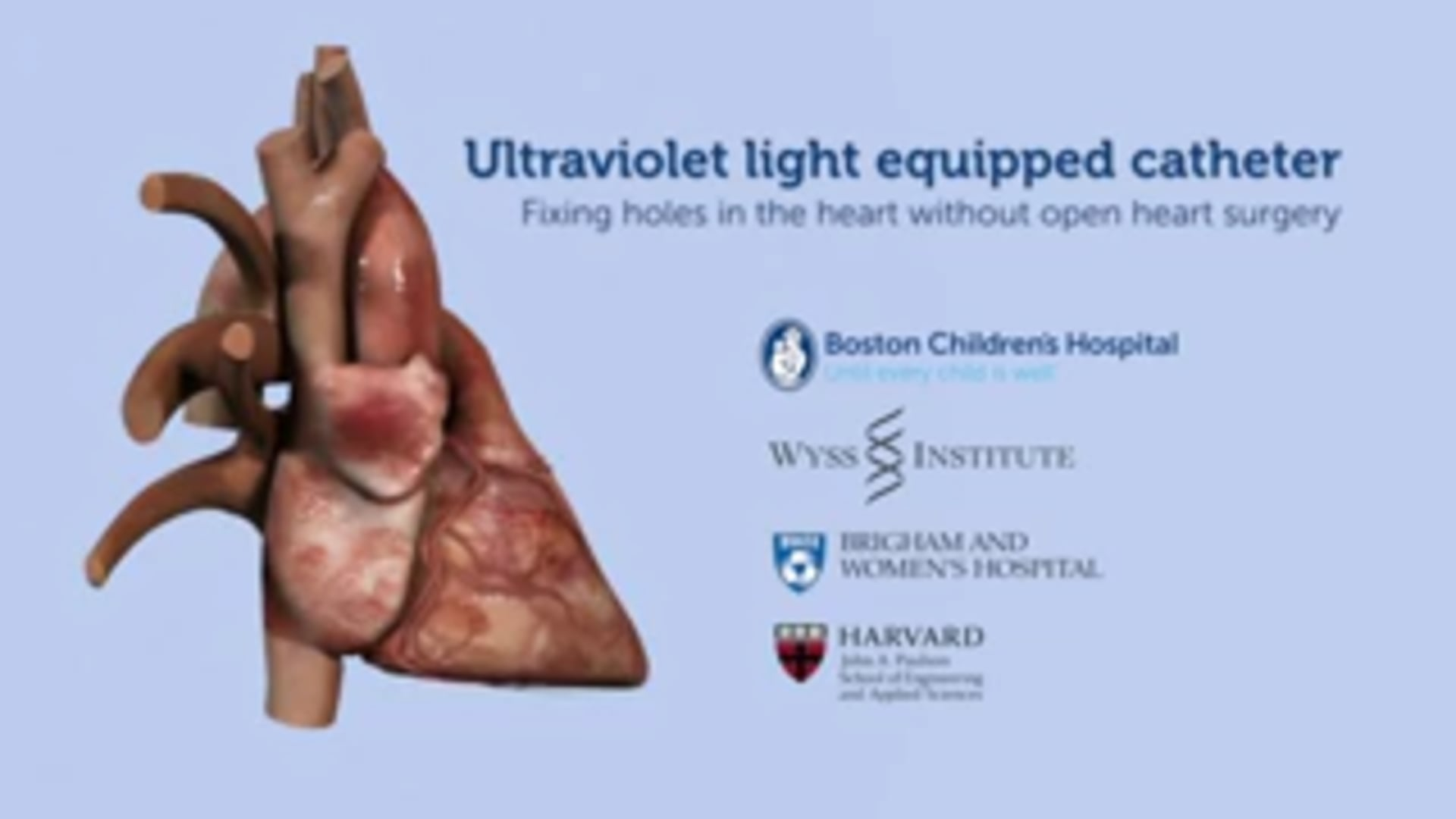 Fixing holes in the heart without invasive surgery Laser Focus World