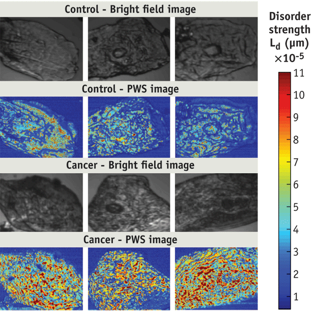 Spectroscopic technique shows potential for early lung cancer detection