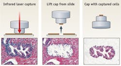 Laser-capture microdissection is an example of a highly successful technology transfer effort involving industry and National Institutes of Health. The original approach uses an infrared laser to activate the EVA polymer placed on top of the target cells (left). The cap with the EVA polymer is removed from the tissue section (center), taking with it the captured cells (right), from which biomolecules can be extracted. Laser-capture microdissection is an example of a highly successful technology transfer effort involving industry and National Institutes of Health. The original approach uses an infrared laser to activate the EVA polymer placed on top of the target cells (left). The cap with the EVA polymer is removed from the tissue section (center), taking with it the captured cells (right), from which biomolecules can be extracted.