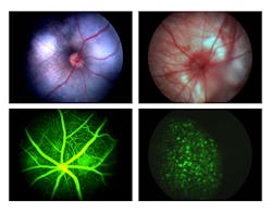 1005 Retinalimaging Fig2 1005 Retinalimaging Fig2