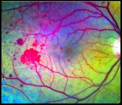 1005 Retinalimaging Fig3 1005 Retinalimaging Fig3