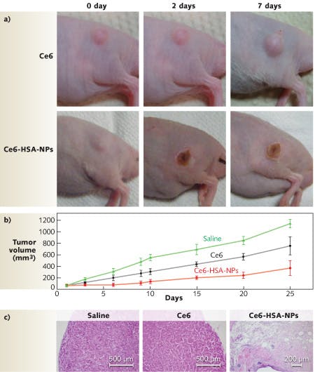 FIGURE 2. Photosensitized (with chlorine e6 or Ce6) human blood proteins (human serum albumin or HSA) can be used to image cancer cells and produce singlet oxygen upon exposure to radiation, visibly killing tumor cells. Images of in-vivo photodynamic therapy (a) are shown after intravenous injection of both the control photosensitizer Ce6 and Ce6-HSA nanoparticles with 30 min irradiation of the tumor site with a 671 nm, 6 J/cm2 laser. Tumor growth data (b) is measured for 25 days. After 10 days of treatment, stained tumor tissue (c) confirms the tumor treated with Ce6-HAS nanoparticles is destroyed. Original magnification is 100X.