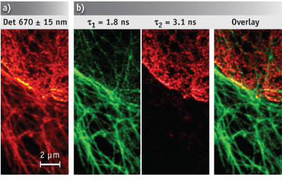 MICROSCOPY/LIVE CELL IMAGING/CELL BIOLOGY: First STED Imaging Of Live ...