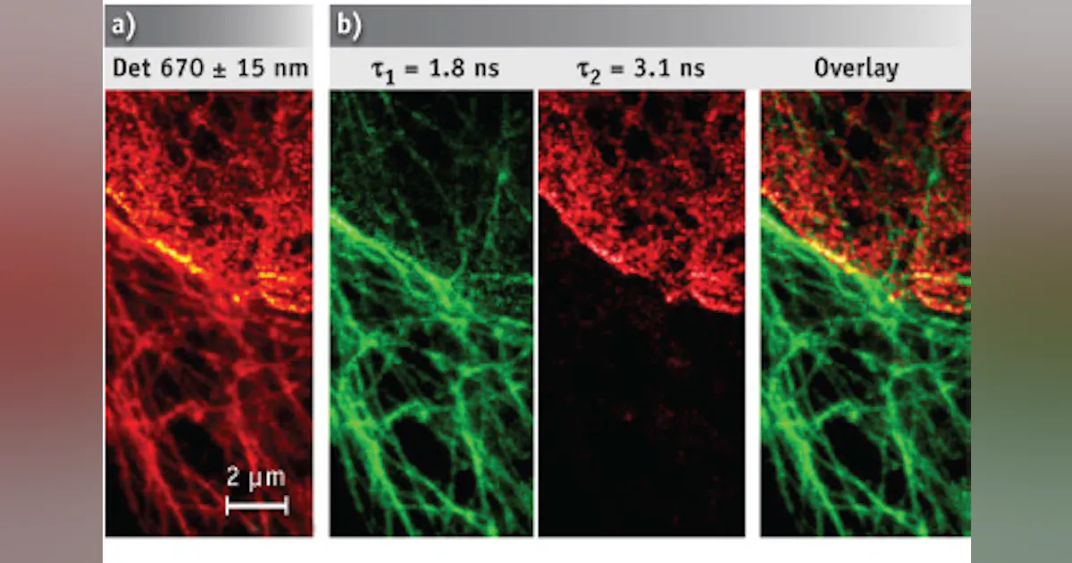 Tausted Microscopy MICROSCOPY/LIVE CELL IMAGING/CELL BIOLOGY: First STED imaging of live ...