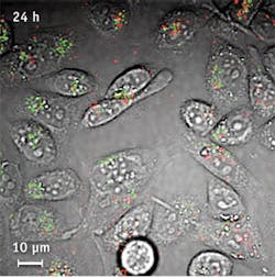 11201bowbreakf4 11201bowbreakf4