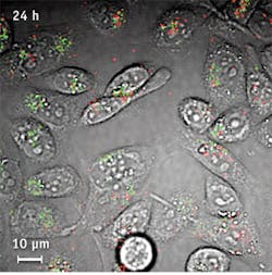 11201bowbreakf4 11201bowbreakf4