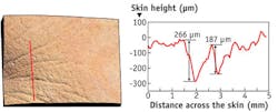 FIGURE 4. GFMesstechnik’s technology records the distortion in phase-shifted fringe patterns of light bouncing off skin along the red line (top). The technology then plots the data (bottom) as the height of the skin versus the distance along it. The data shown here, for example, indicate two significant dips, or wrinkles, of 266 and 187 µm in the height of the skin. FIGURE 4. GFMesstechnik’s technology records the distortion in phase-shifted fringe patterns of light bouncing off skin along the red line (top). The technology then plots the data (bottom) as the height of the skin versus the distance along it. The data shown here, for example, indicate two significant dips, or wrinkles, of 266 and 187 µm in the height of the skin.