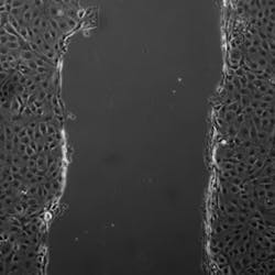 120217 Inhibition Of Endocytosis 120217 Inhibition Of Endocytosis
