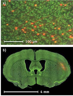 The NanoZoomer can scan an entire brain slice at a resolution that allows the visualization of individual neurons anywhere within the tissue section (a) and still allow the user to zoom out to look at the entire tissue section (b), all in a single digital-slide image.