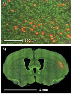 The NanoZoomer can scan an entire brain slice at a resolution that allows the visualization of individual neurons anywhere within the tissue section (a) and still allow the user to zoom out to look at the entire tissue section (b), all in a single digital-slide image. The NanoZoomer can scan an entire brain slice at a resolution that allows the visualization of individual neurons anywhere within the tissue section (a) and still allow the user to zoom out to look at the entire tissue section (b), all in a single digital-slide image.