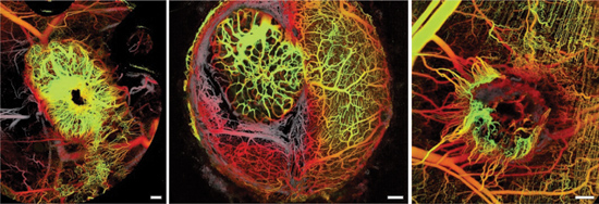 OPTICAL COHERENCE TOMOGRAPHY: OCT For Oncology: Preclinical Progress ...