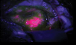 1209bow Break Fig3 1209bow Break Fig3