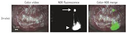 FIGURE 2. Identification of the sentinel lymph node (arrow) in pig colon after in-vivo injection (arrowhead) of 0.1 cc of 10 mM HSA800. Shown are the color video (left), NIR fluorescence (middle), and pseudo-colored (lime green) merge of the two (right). FIGURE 2. Identification of the sentinel lymph node (arrow) in pig colon after in-vivo injection (arrowhead) of 0.1 cc of 10 mM HSA800. Shown are the color video (left), NIR fluorescence (middle), and pseudo-colored (lime green) merge of the two (right).