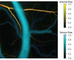 1209bowlevif1 1209bowlevif1