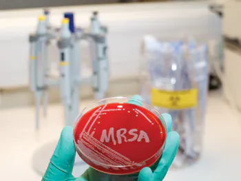 GENOMICS/DISEASE CONTROL: First-ever stoppage of MRSA outbreak by gene ...
