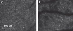 FIGURE 1. An adaptive optics-based retinal-imaging system—designed by students at the School of Optometry at Indiana University, under the supervision of Ann Elsner and Stephen Burns—enables quick detection of age-related eye ailments. The system highlights the differences between cone photoreceptors of a healthy 30-year old patient (a) and those of an elderly patient affected by age-related macular degeneration (b), where dark spots indicate regions of damage or inactivity. FIGURE 1. An adaptive optics-based retinal-imaging system—designed by students at the School of Optometry at Indiana University, under the supervision of Ann Elsner and Stephen Burns—enables quick detection of age-related eye ailments. The system highlights the differences between cone photoreceptors of a healthy 30-year old patient (a) and those of an elderly patient affected by age-related macular degeneration (b), where dark spots indicate regions of damage or inactivity.