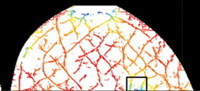 1301bownews Mammogram