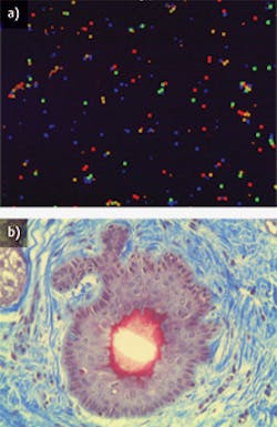 FIGURE 1. (a) Fluorescent microspheres ranging in size from 3 to 5 &mu;m were imaged using a Mitutoyo plan apochromat infinity-corrected long working distance 5X objective, and (b) a dermal skin cell with a trichrome stain was imaged with a 20X version of the same objective.