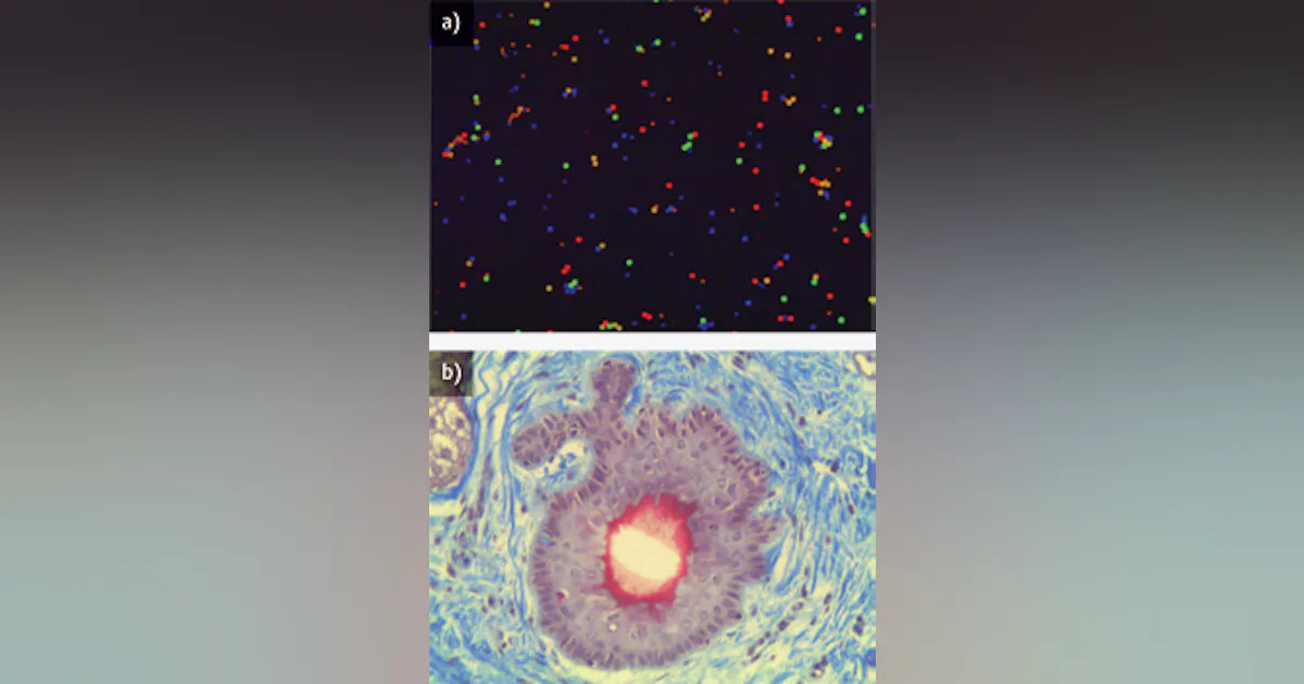 PRODUCT FOCUS: Microscope objectives | Laser Focus World