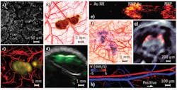 FIGURE 3. Multicontrast PAT highlights tissue anatomy, function, molecular biomarkers, and gene expression. (a) OR-PAM of epithelial cell nuclei in the intestinal villi of a mouse ex-vivo was produced by excitation of DNA and RNA. AR-PAM depicts (b) a subcutaneously inoculated B16 melanoma and the surrounding vasculature on the back of a living mouse, and (c) a melanoma labeled with targeted gold nanocages. (d) Dual-contrast ultrasound (gray) and photoacoustic (green) imaging shows a tumor labeled with single-walled carbon nanotubes in a living mouse. (e) Magnetomotive PAT highlights a polyvinyl alcohol phantom with three inclusions, each 2 mm in diameter. The left inclusion contains gold nanorods (Au NR) with absorption comparable to the 3 nM magnetic-gold hybrid nanoparticles (MNP-Au) placed in the center inclusion, and the right inclusion contains 3 nM magnetic nanoparticles (MNP). (f) AR-PAM reveals a lacZ-marked 9L gliosarcoma and the surrounding vasculature under the scalp of a living rat. (g) PACT shows the brain of a 6-month-old, mCherry-expressing transgenic zebrafish. (h) OR-PAM visualizes blood flow velocity and direction in the ear of a living mouse. FIGURE 3. Multicontrast PAT highlights tissue anatomy, function, molecular biomarkers, and gene expression. (a) OR-PAM of epithelial cell nuclei in the intestinal villi of a mouse ex-vivo was produced by excitation of DNA and RNA. AR-PAM depicts (b) a subcutaneously inoculated B16 melanoma and the surrounding vasculature on the back of a living mouse, and (c) a melanoma labeled with targeted gold nanocages. (d) Dual-contrast ultrasound (gray) and photoacoustic (green) imaging shows a tumor labeled with single-walled carbon nanotubes in a living mouse. (e) Magnetomotive PAT highlights a polyvinyl alcohol phantom with three inclusions, each 2 mm in diameter. The left inclusion contains gold nanorods (Au NR) with absorption comparable to the 3 nM magnetic-gold hybrid nanoparticles (MNP-Au) placed in the center inclusion, and the right inclusion contains 3 nM magnetic nanoparticles (MNP). (f) AR-PAM reveals a lacZ-marked 9L gliosarcoma and the surrounding vasculature under the scalp of a living rat. (g) PACT shows the brain of a 6-month-old, mCherry-expressing transgenic zebrafish. (h) OR-PAM visualizes blood flow velocity and direction in the ear of a living mouse.