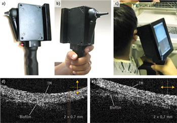 FIGURE 1. This handheld device uses optical coherence tomography (OCT) to reveal bacterial biofilms&mdash;behind the tympanic membrane (TM)&mdash;that cause ear infections.