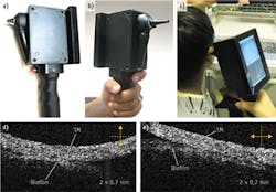FIGURE 1. This handheld device uses optical coherence tomography (OCT) to reveal bacterial biofilms—behind the tympanic membrane (TM)—that cause ear infections. FIGURE 1. This handheld device uses optical coherence tomography (OCT) to reveal bacterial biofilms—behind the tympanic membrane (TM)—that cause ear infections.