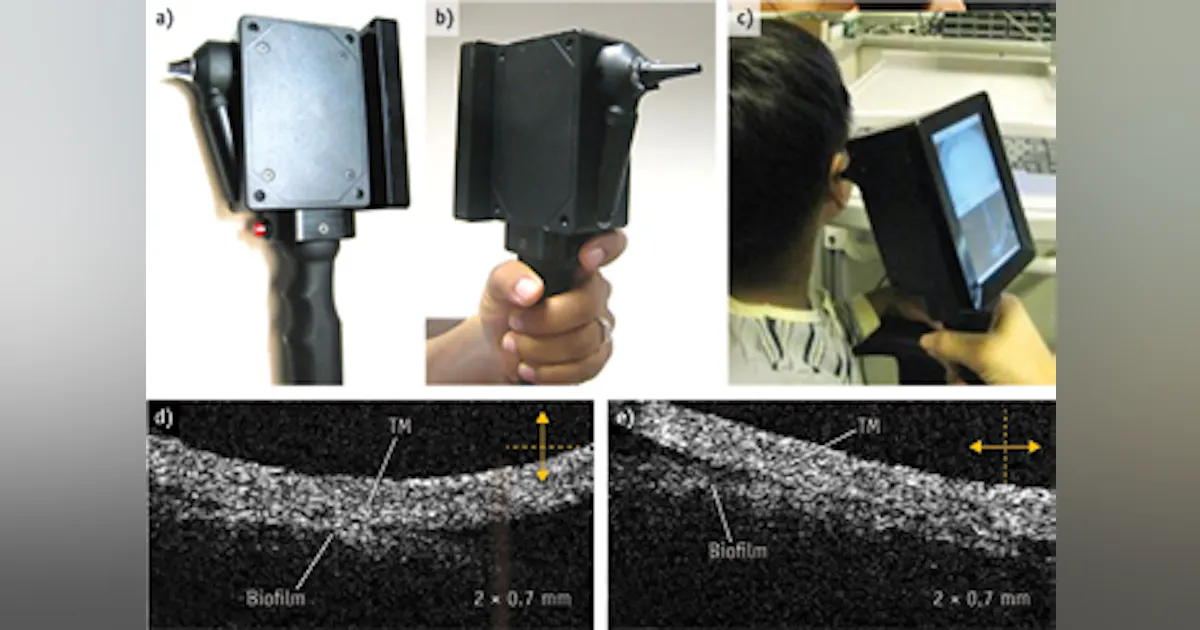 Hand Held Oct NEAR-INFRARED OPTICS/OCT/ONCOLOGY: Handheld optical devices for the ...