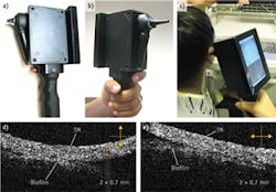 FIGURE 1. This handheld device uses optical coherence tomography (OCT) to reveal bacterial biofilms&mdash;behind the tympanic membrane (TM)&mdash;that cause ear infections.