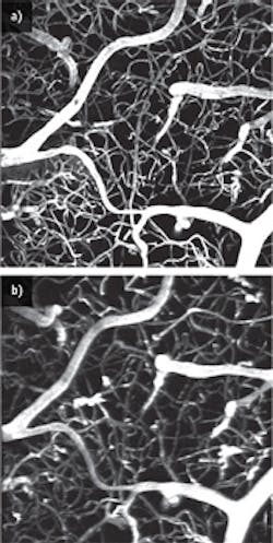 1305bowbreakf1 1305bowbreakf1