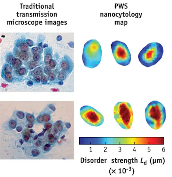 SPECTROSCOPY/ONCOLOGY/GYNECOLOGY: First-ever minimally invasive ovarian ...
