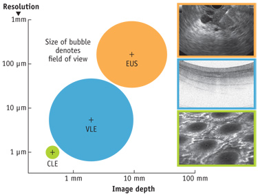 FIGURE 1. OCT meets an unmet need in terms of both resolution and imaging depth for esophageal assessment. It fills a gap between endoscopic ultrasound (EUS) and confocal laser endomicroscopy.