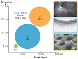 FIGURE 1. OCT meets an unmet need in terms of both resolution and imaging depth for esophageal assessment. It fills a gap between endoscopic ultrasound (EUS) and confocal laser endomicroscopy. FIGURE 1. OCT meets an unmet need in terms of both resolution and imaging depth for esophageal assessment. It fills a gap between endoscopic ultrasound (EUS) and confocal laser endomicroscopy.