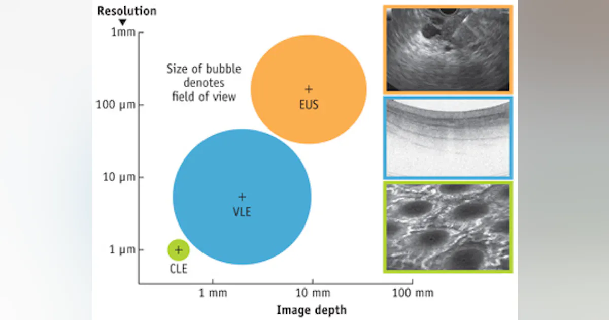 OPTICAL COHERENCE TOMOGRAPHY/GASTROENTEROLOGY: Advanced OCT: Next-gen ...