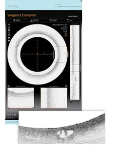 FIGURE 4. Acquired data appears on the 30 in. main display, where the interface shows transverse and longitudinal sections through 5 GB datasets. Inset: A section of abnormal tissue. FIGURE 4. Acquired data appears on the 30 in. main display, where the interface shows transverse and longitudinal sections through 5 GB datasets. Inset: A section of abnormal tissue.