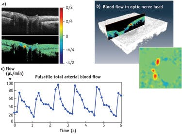 FIGURE 4. A comparison of OCT imaging approaches shows (a) an OCT intensity image and a corresponding OCT Doppler image of the optic nerve head in the retina obtained at a 400 kHz axial scan rate. (b) A representative 3D volume of the optic nerve head from a rapidly acquired sequence of OCT volumes enables quantitative measurement of blood flow. (c) Analysis of multiple repeated 3D Doppler volumes of the optic nerve head enabled plotting of pulsatile blood flow into the eye.