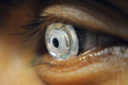 1309bowbreak Fig3 1309bowbreak Fig3