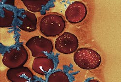 1309bowbreak Fig7 1309bowbreak Fig7