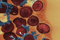 1309bowbreak Fig7 1309bowbreak Fig7