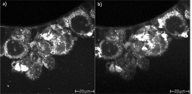 In these Chinese hamster ovary (CHO) cells, an image (a) taken at 300 MHz with the relatively small and inexpensive Femtolasers Integral Core is comparable to an image (b) taken with a more expensive, traditional 80 MHz laser. In some regions, the Core shows even higher contrast.