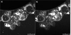 In these Chinese hamster ovary (CHO) cells, an image (a) taken at 300 MHz with the relatively small and inexpensive Femtolasers Integral Core is comparable to an image (b) taken with a more expensive, traditional 80 MHz laser. In some regions, the Core shows even higher contrast. In these Chinese hamster ovary (CHO) cells, an image (a) taken at 300 MHz with the relatively small and inexpensive Femtolasers Integral Core is comparable to an image (b) taken with a more expensive, traditional 80 MHz laser. In some regions, the Core shows even higher contrast.