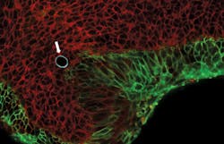 1401bowbreak Fig4 1401bowbreak Fig4