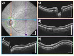 1401bowbreakf2 1401bowbreakf2