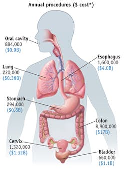 1401bowgenovaf5 1401bowgenovaf5