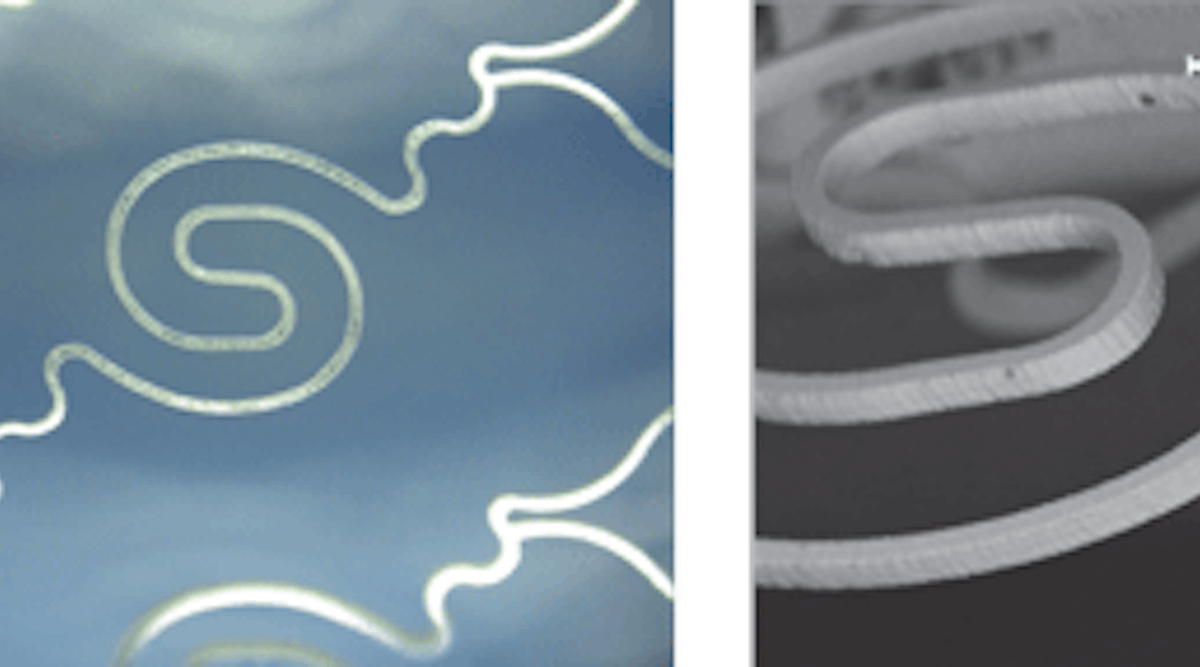 FIGURE 1. Two photos of micro-stents machined by the Spirit laser.