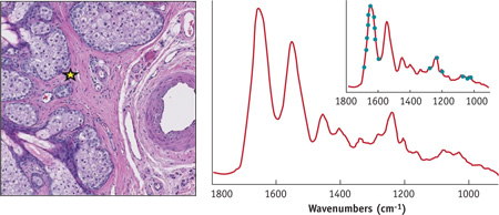 A representative single-pixel spectra collected from the eyelid tissue section shown in Fig. 4 shows high SNR and spectral fidelity. The inset illustrates the concept of the new sparse data collection modality.