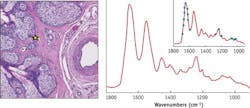 A representative single-pixel spectra collected from the eyelid tissue section shown in Fig. 4 shows high SNR and spectral fidelity. The inset illustrates the concept of the new sparse data collection modality. A representative single-pixel spectra collected from the eyelid tissue section shown in Fig. 4 shows high SNR and spectral fidelity. The inset illustrates the concept of the new sparse data collection modality.