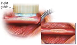 1403bowbreakf6 1403bowbreakf6