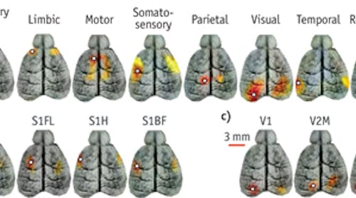 Functional connectivity maps in a mouse brain acquired noninvasively by fcPAT depict correlation of the eight main functional regions (a), the four subregions of the somatosensory cortex (b), and the three subregions of the visual cortex (c). The white circles indicate seed regions: S1HL, primary somatosensory cortex &ndash; hindlimb region; S1FL, primary somatosensory &ndash; forelimb region; S1H, primary somatosensory &ndash; head region; S1BF, primary somatosensory &ndash; barrel field; V1, primary visual cortex; V2M, secondary visual cortex &ndash; medial region; and V2L, secondary visual cortex &ndash; lateral region.