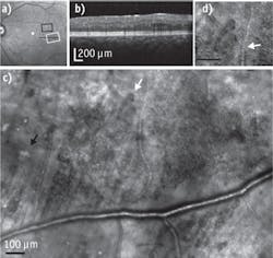 1405bowbreakf5 1405bowbreakf5