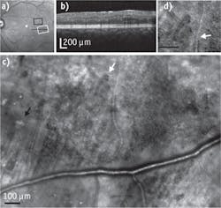 1405bowbreakf5 1405bowbreakf5